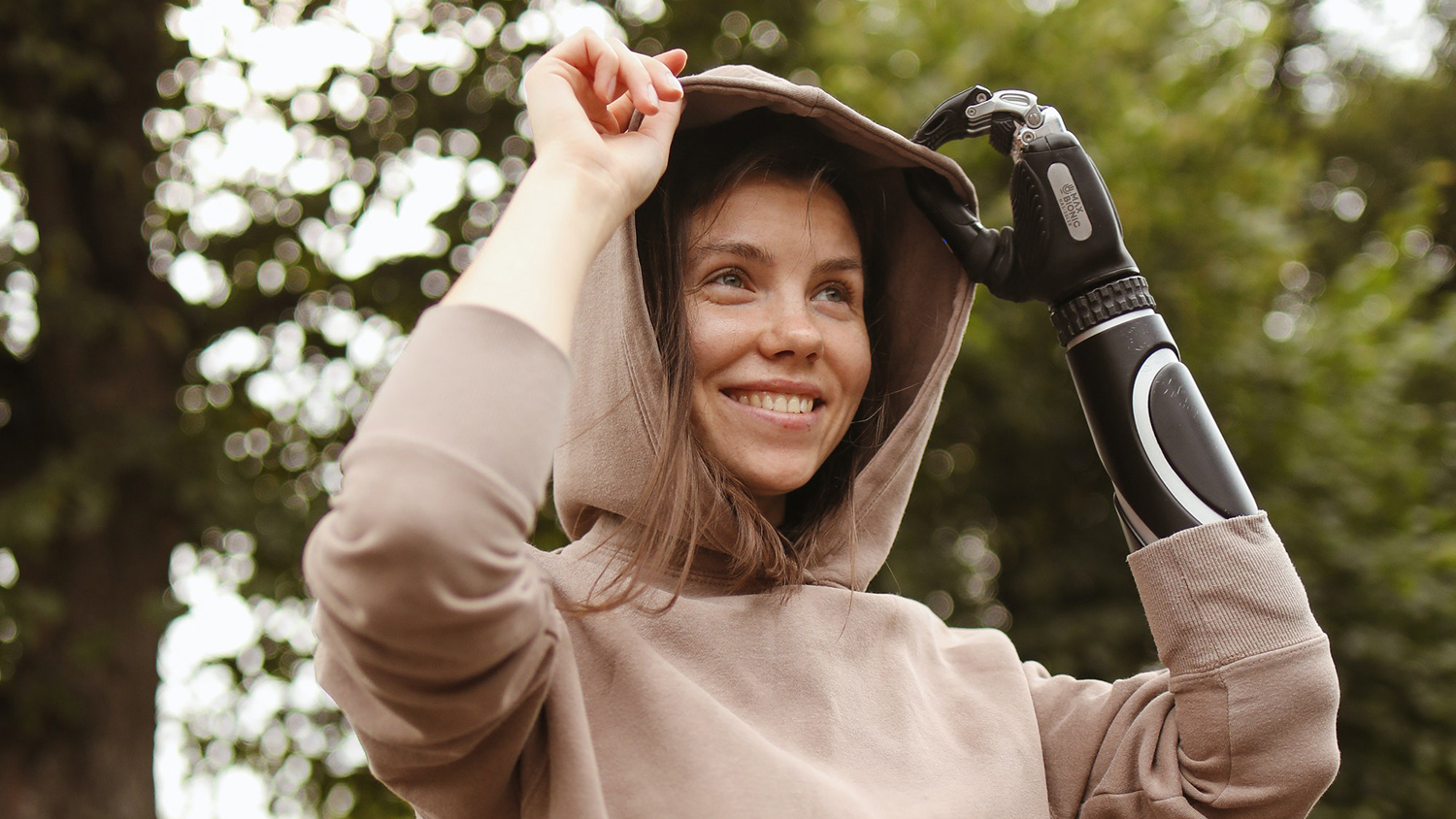 Mujer con una prótesis en el brazo - seguro de incapacidad laboral
